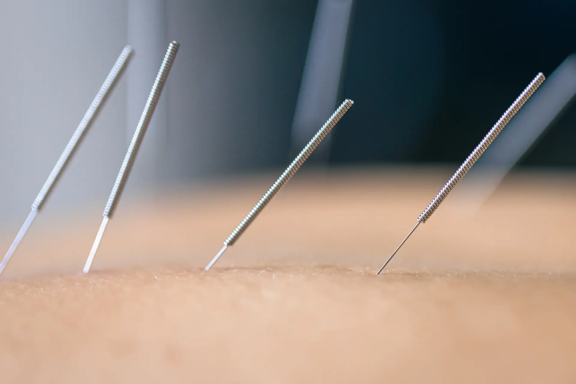 Dry needling-naalden in een spier